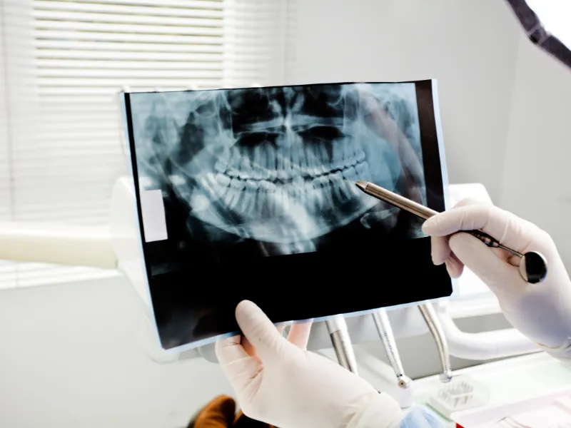 Oral Cancer Screening