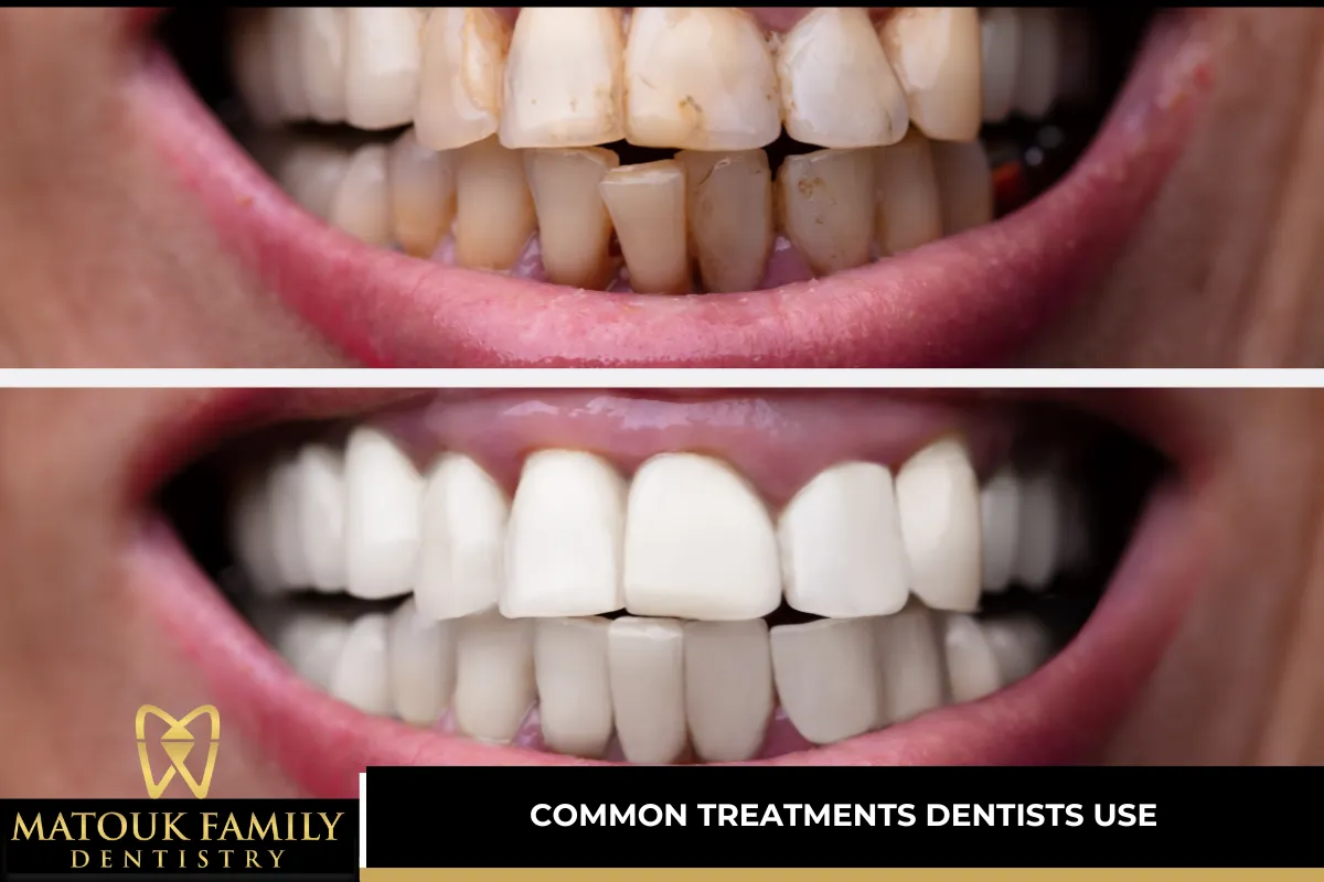 Common Treatments Dentists Use