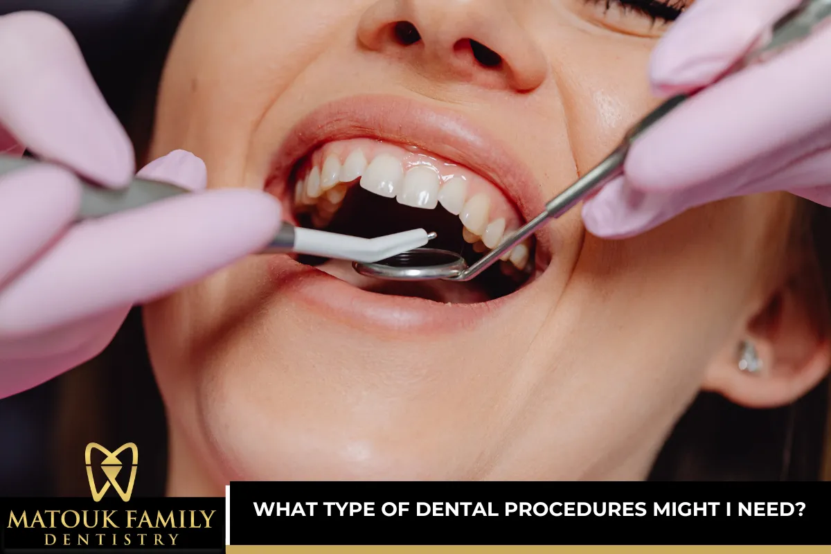 What Type of Dental Procedures Might I Need?