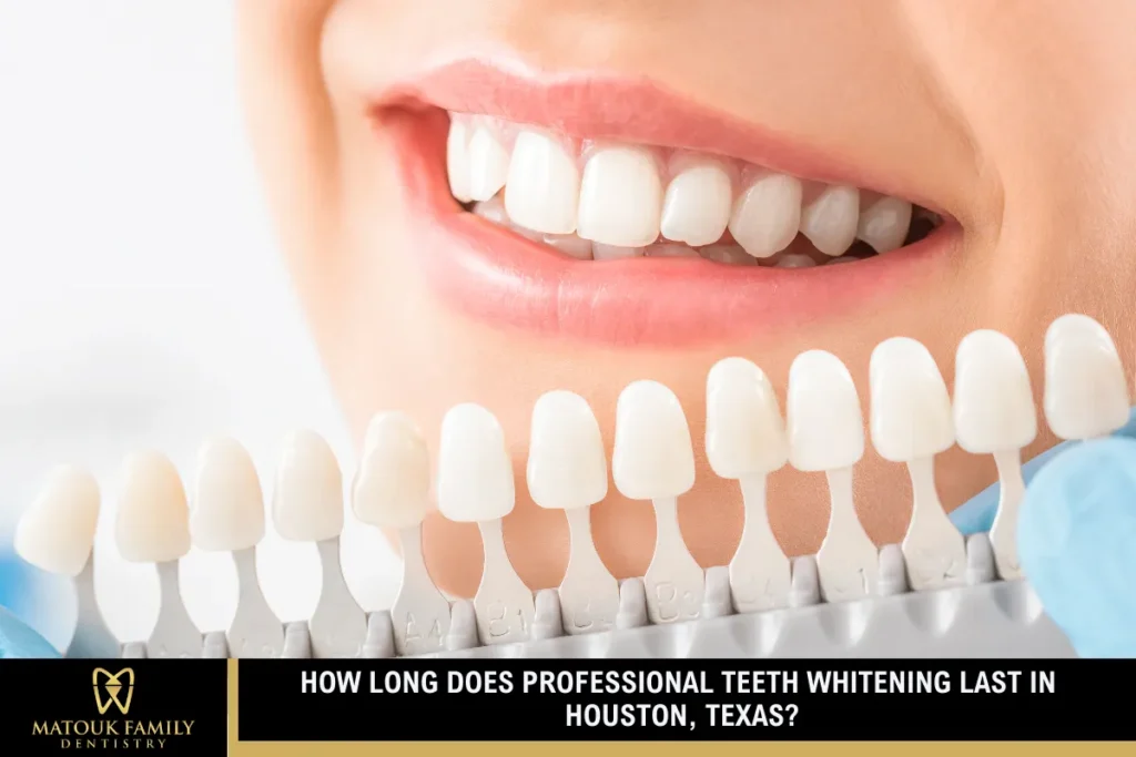 How Long Does Professional Teeth Whitening Last in Houston, Texas?