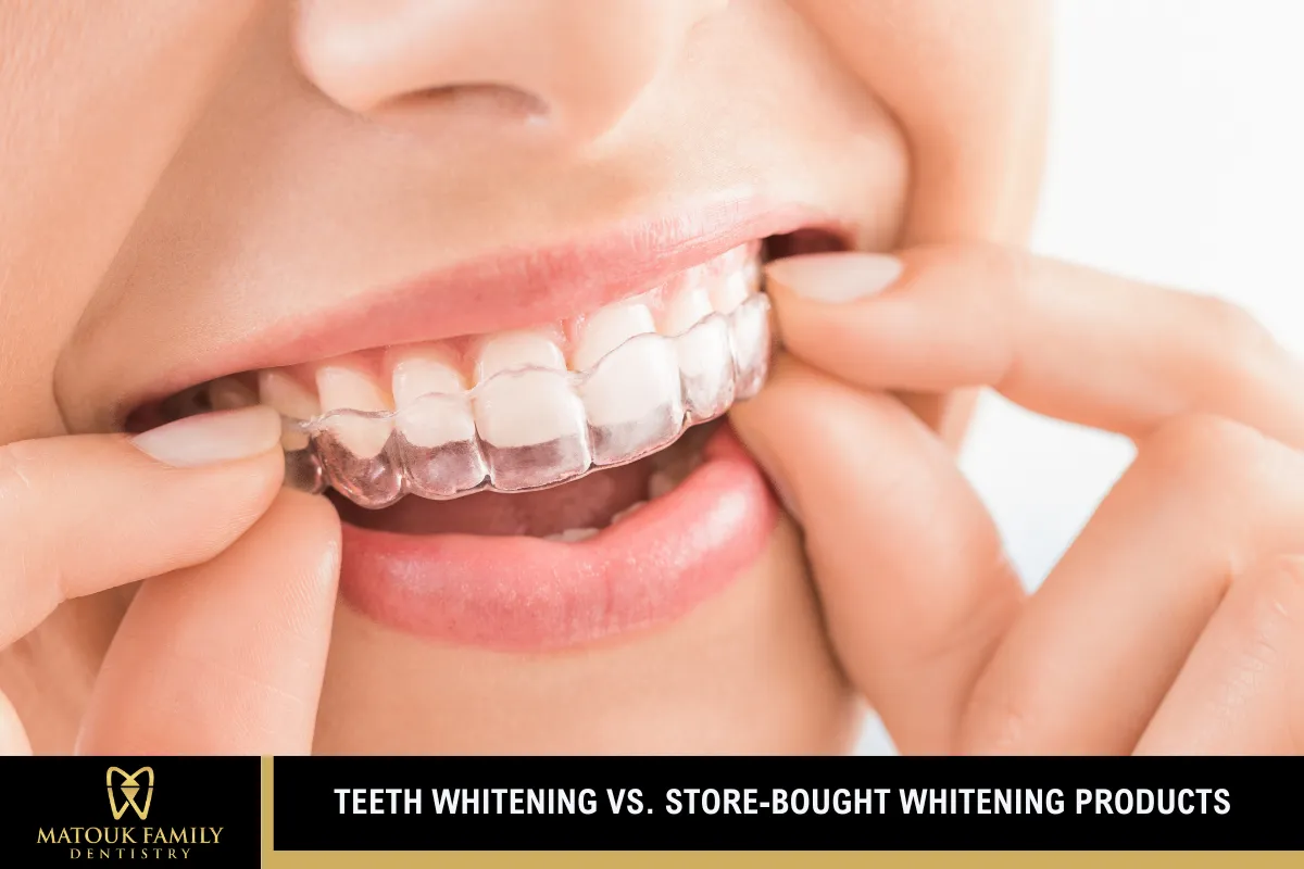 Teeth Whitening vs. Store-Bought Whitening Products