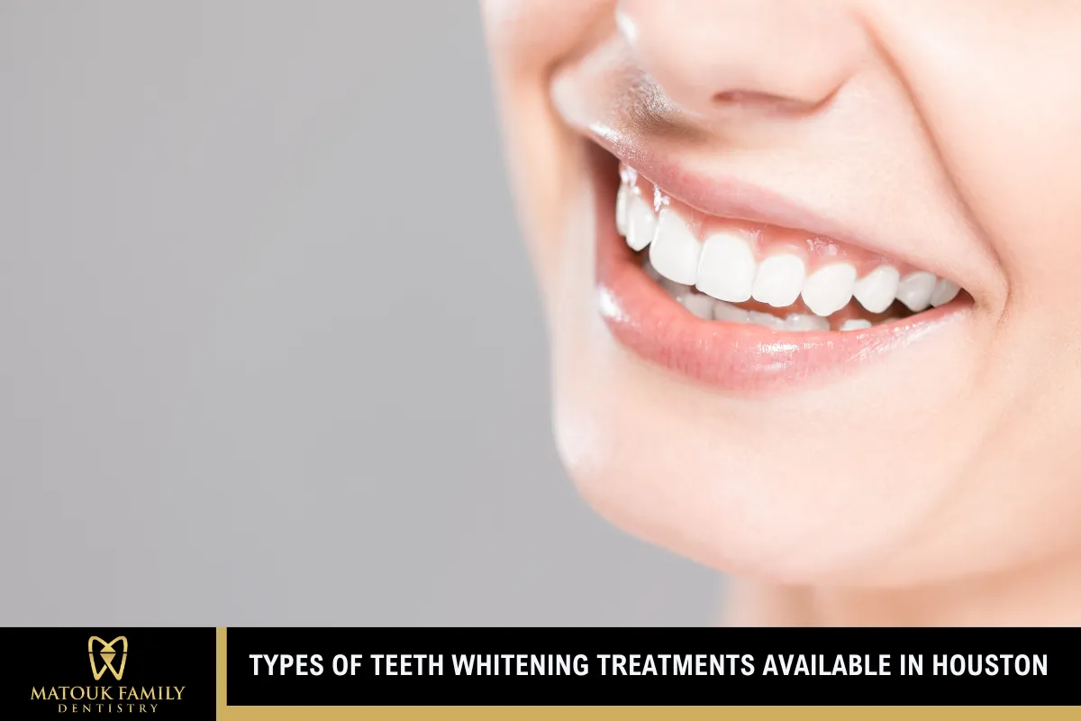 Types of Teeth Whitening Treatments Available in Houston