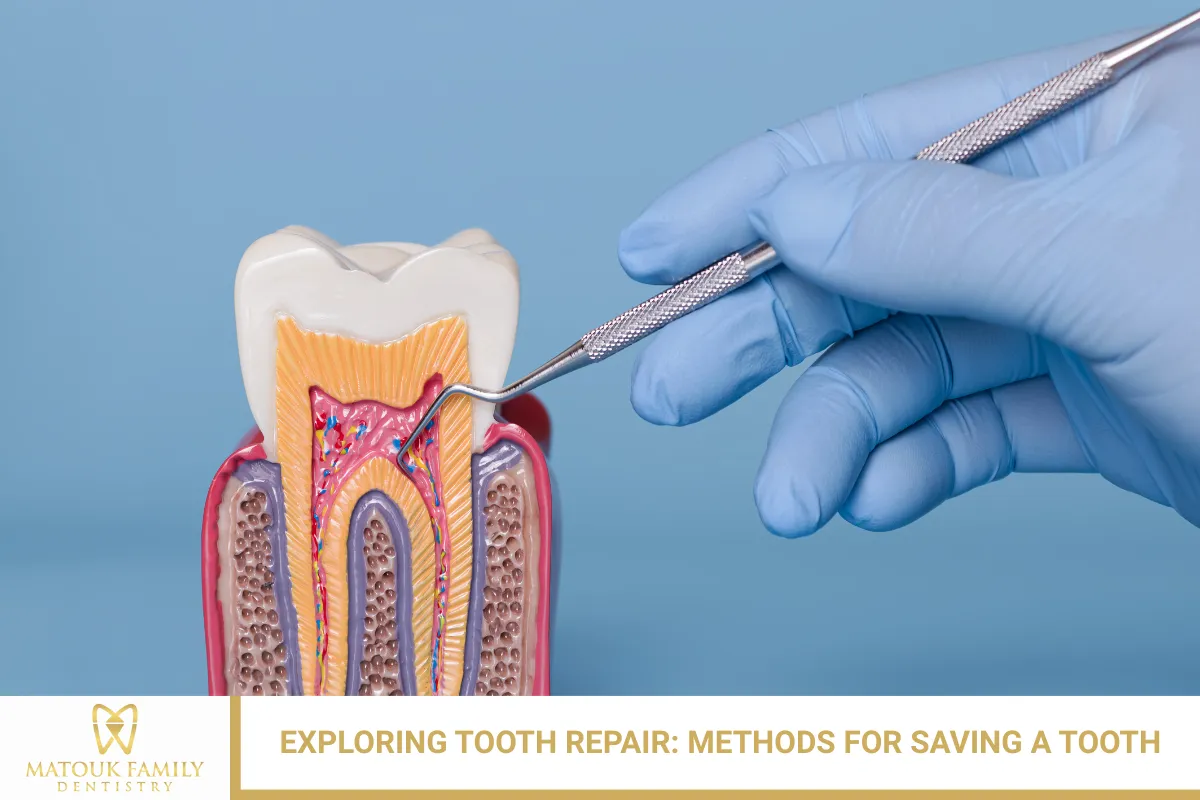 Exploring Tooth Repair: Methods for Saving a Tooth