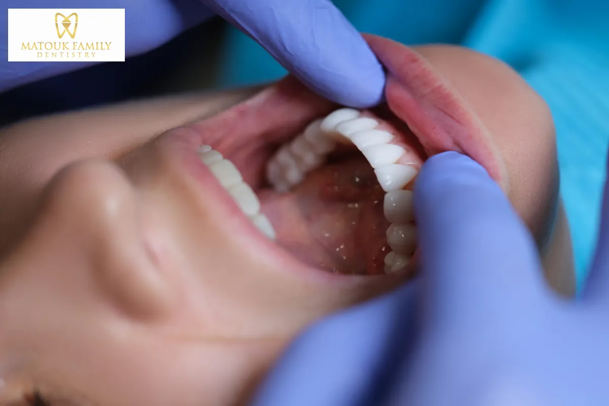 Making the Right Choice: Questions to Ask Your Dentist