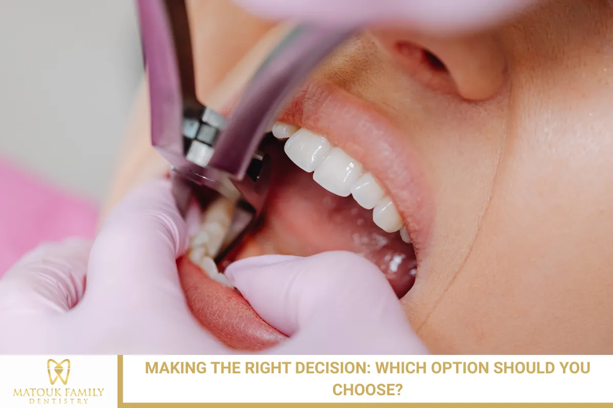 Making the Right Decision: Which Option Should You Choose?