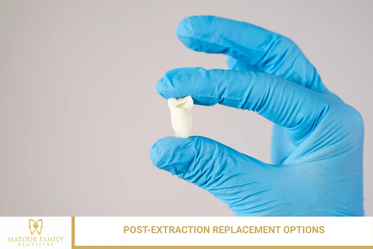 Post-Extraction Replacement Options