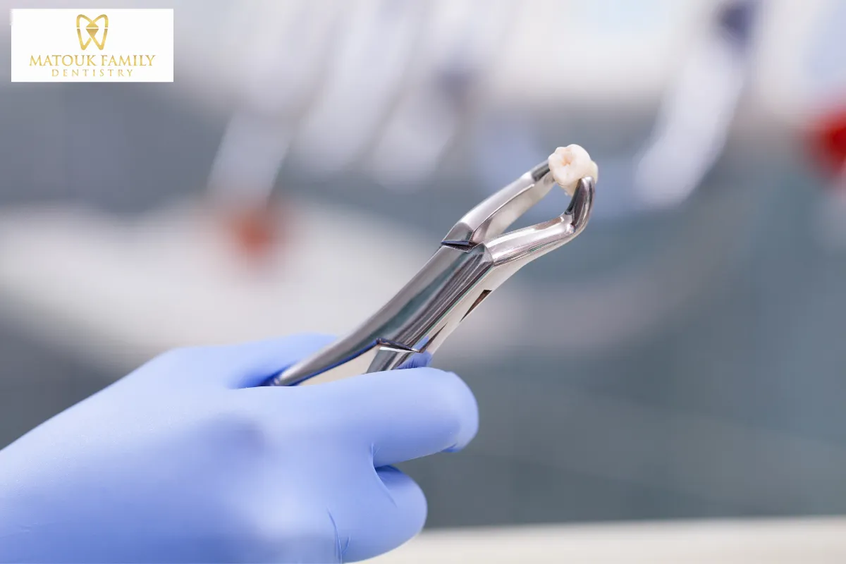 Tooth Extractions