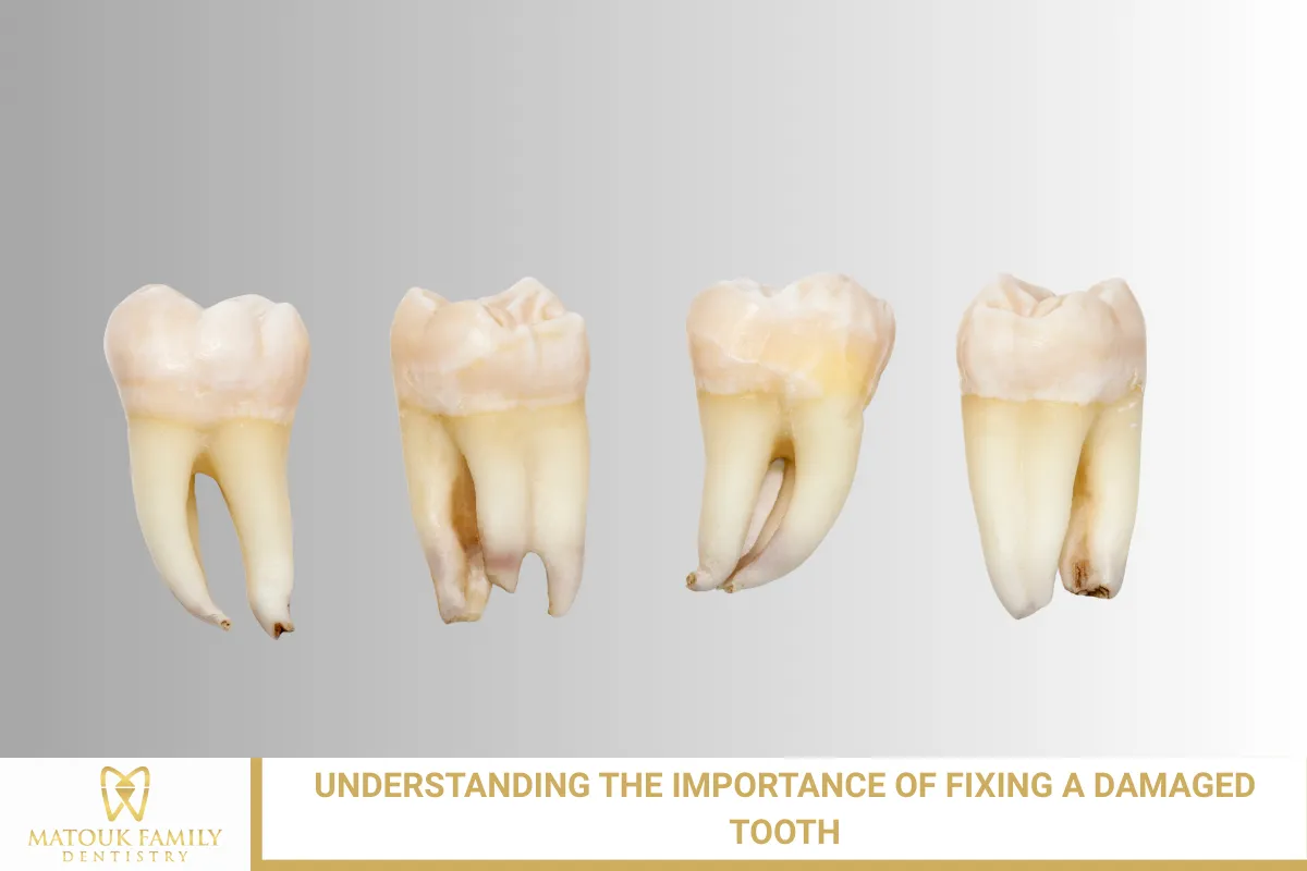 Understanding the Importance of Fixing a Damaged Tooth