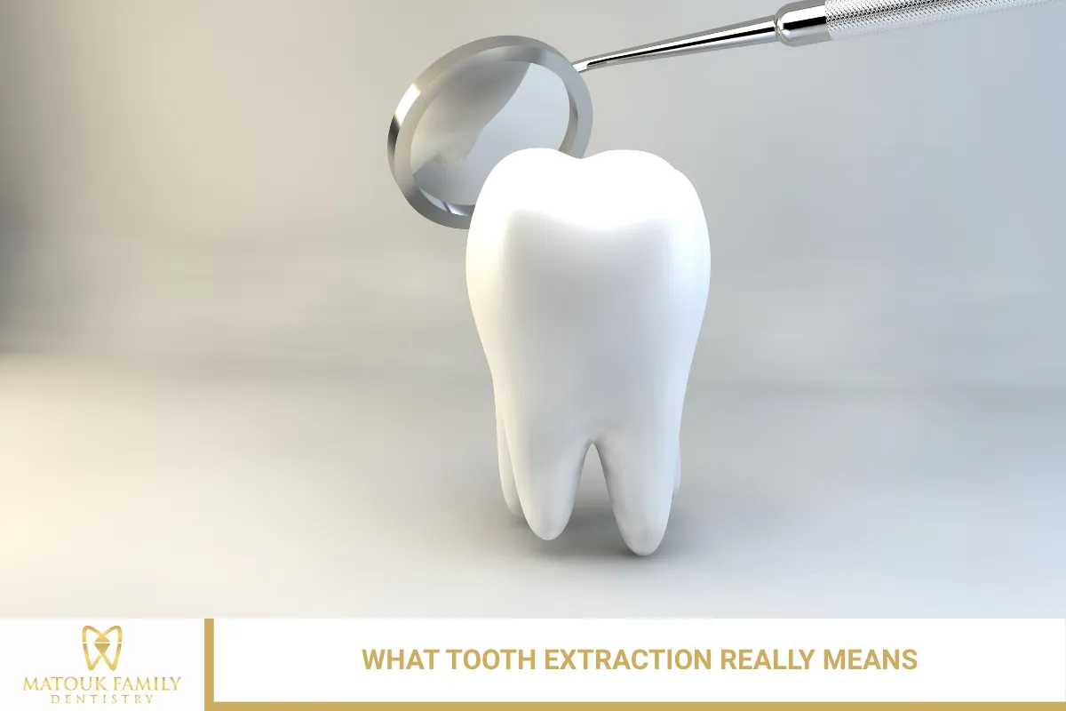 What Tooth Extraction Really Means