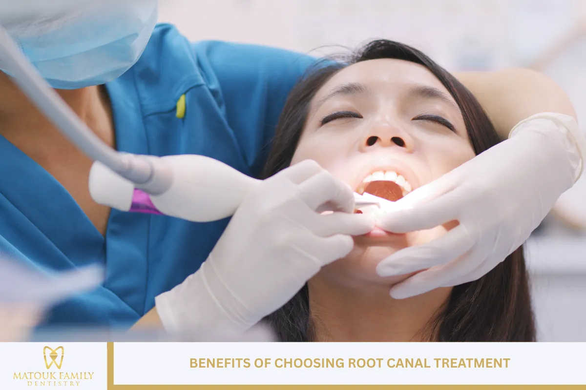 Benefits of Choosing Root Canal Treatment