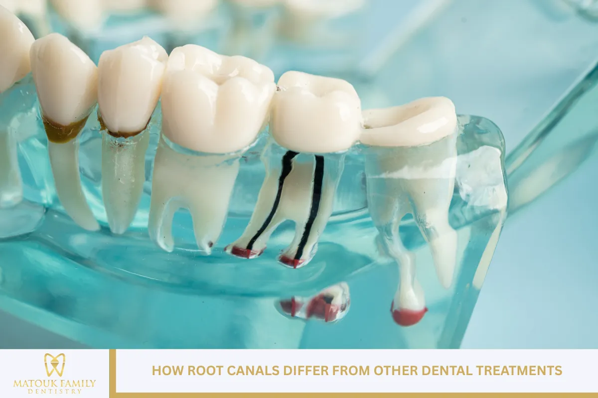 How Root Canals Differ from Other Dental Treatments