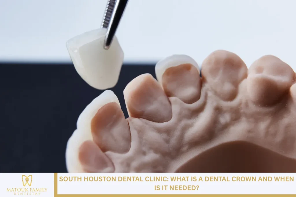 South Houston Dental Clinic: What Is a Dental Crown, and When Is It Needed?