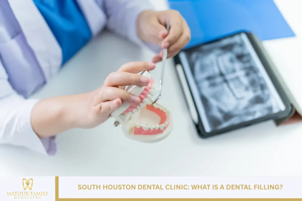 South Houston Dental Clinic: What Is a Dental Filling?