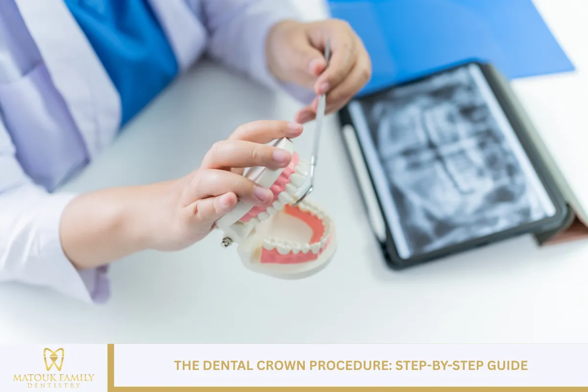 The Dental Crown Procedure: Step-by-Step Guide