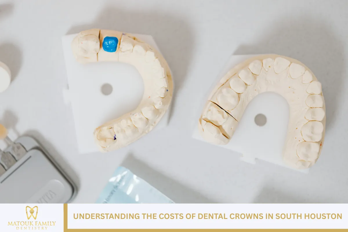 Understanding the Costs of Dental Crowns in South Houston