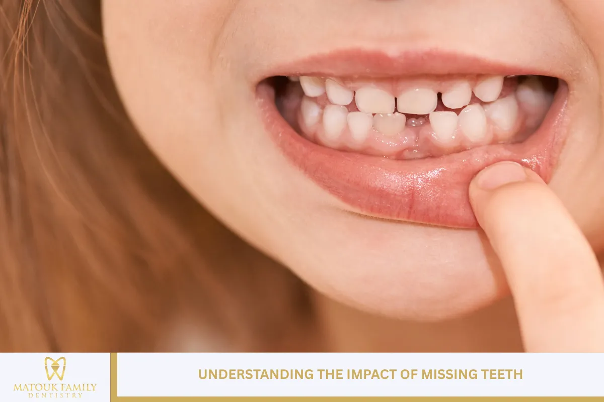 Understanding the Impact of Missing Teeth