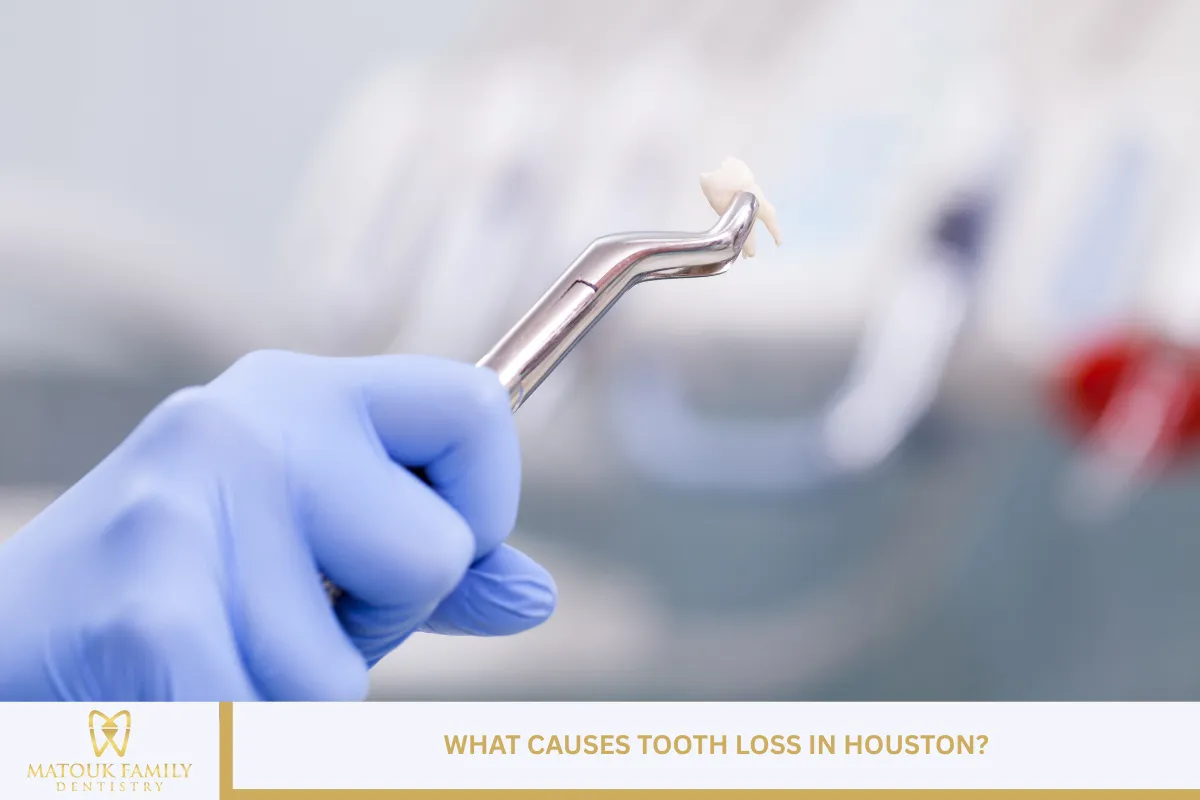 What Causes Tooth Loss in Houston?