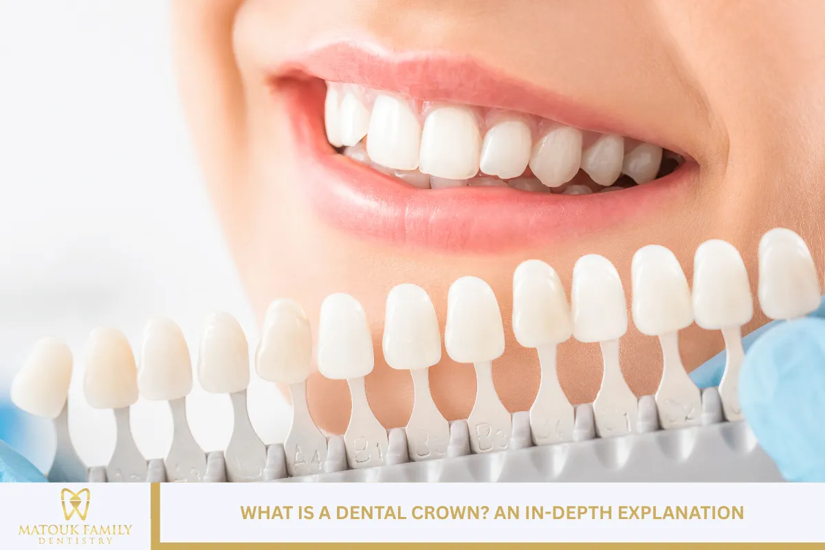 What is a Dental Crown? An In-Depth Explanation