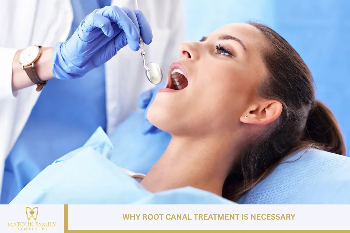 Why Root Canal Treatment Is Necessary
